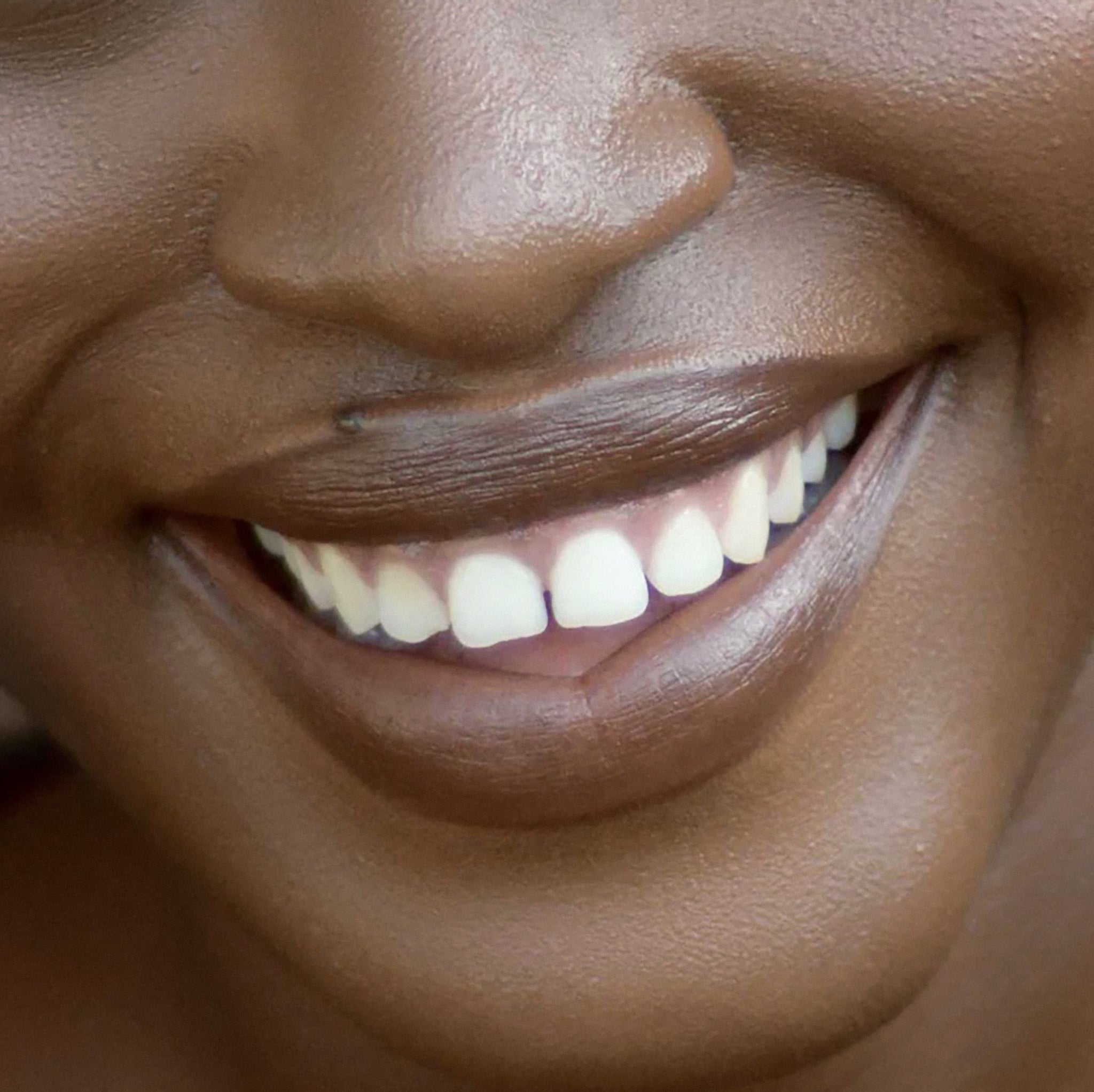 Happy black woman big smile with white teeth close-up.