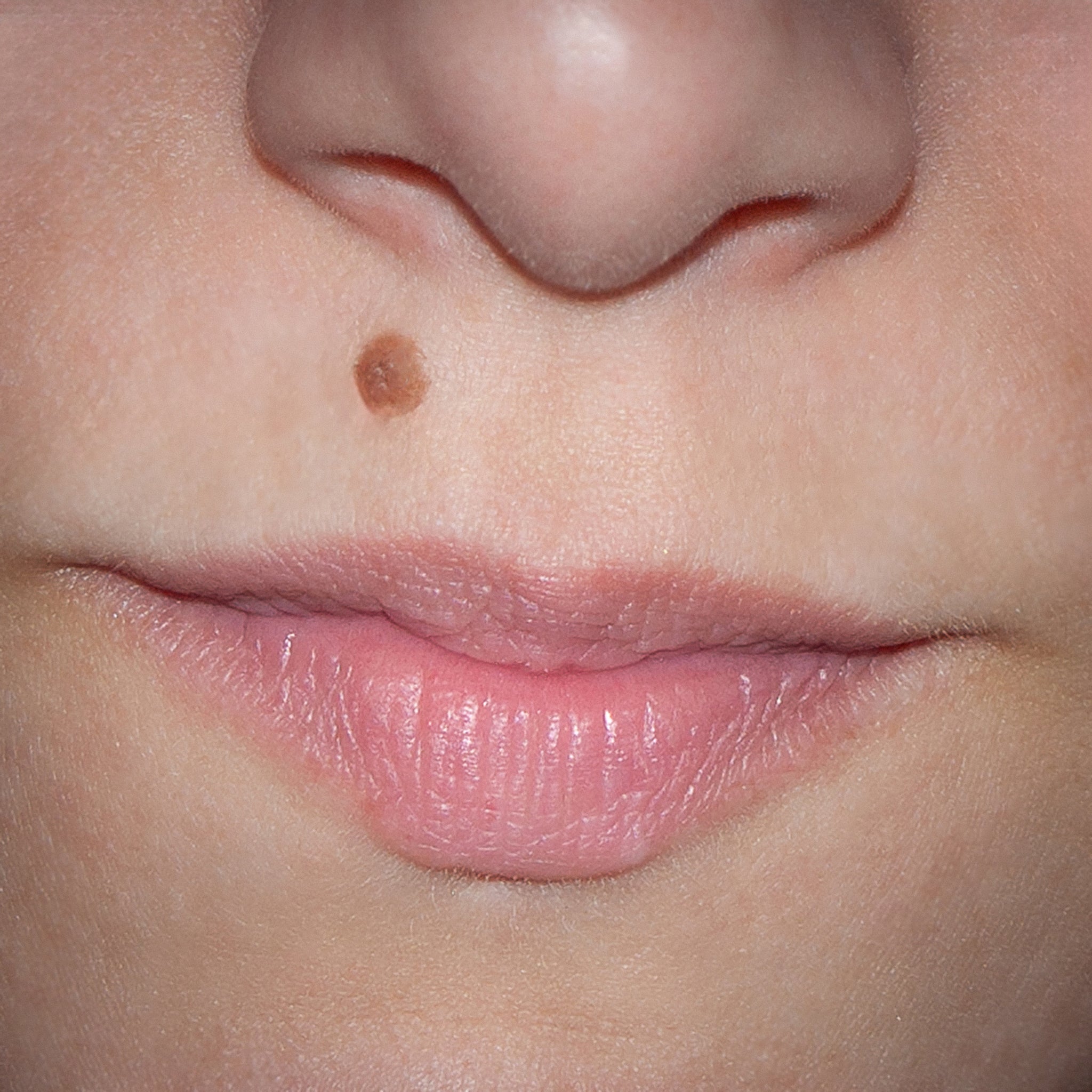 Happy white caucasian girl smile close-up with beauty mark above upper lip.