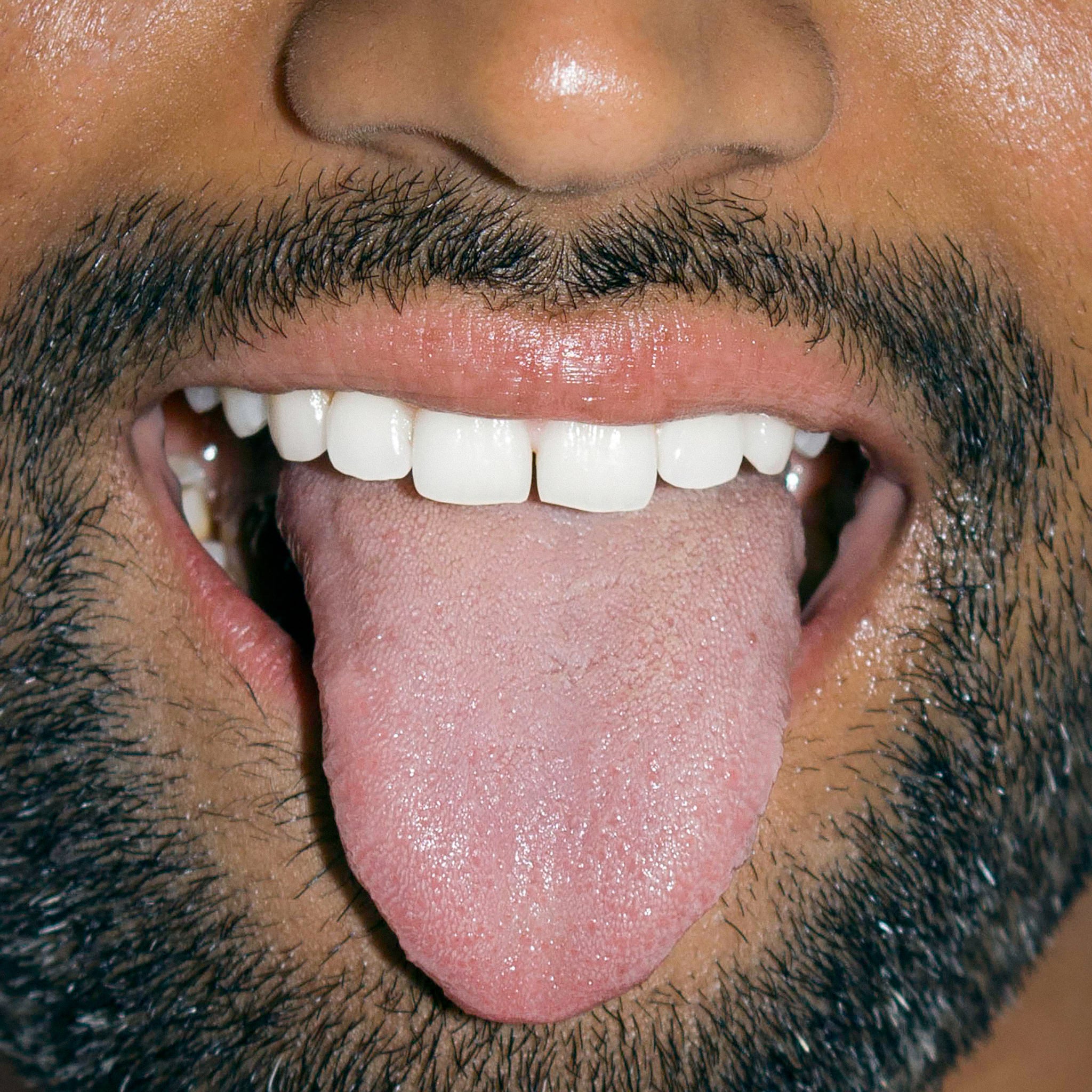 A close-up of a man smiling with his tongue sticking out, showing his teeth and facial hair.